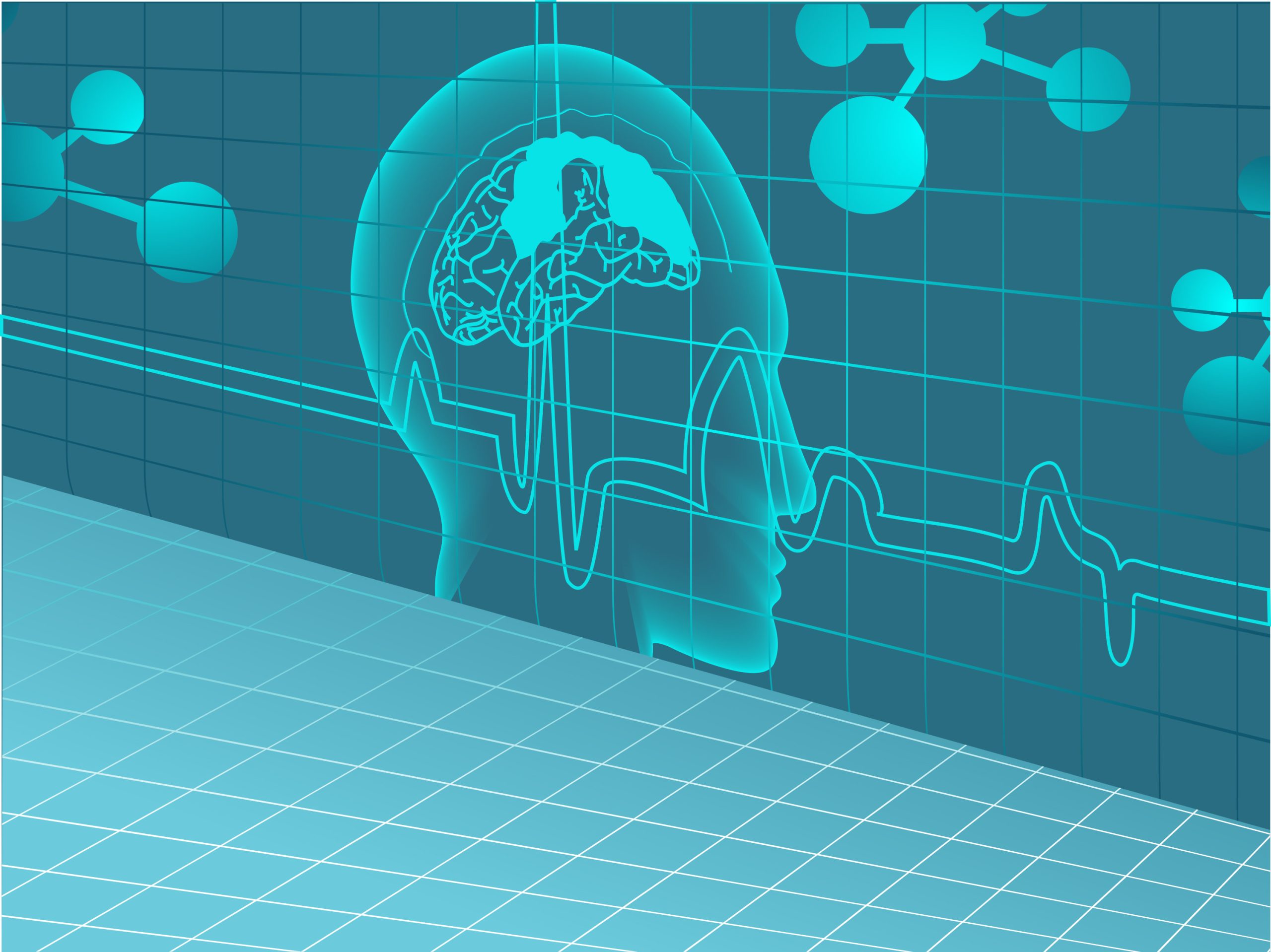 graphic showing a brain and brain wave scan 